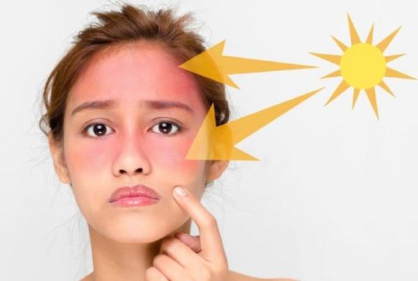 آسیب های ناشی از آفتاب بر پوست و عوارض آن