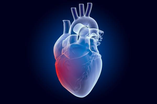 احتمال بقاء زنان بعد از جراحی بای پس قلب نسبت به مردان کمتر است